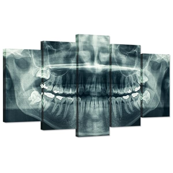 iHAPPYWALL Modern 5 Panel Canvas Wall Art: X-Ray Dental Tooth Print for Dental Rooms & Living Spaces - Ready to Hang!
