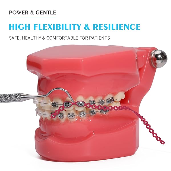 ANNWAH ANNWAH Colorful Orthodontic Braces Rubber Chains for Effective Dental Treatment Long Red Power Chains - View 2 of 6